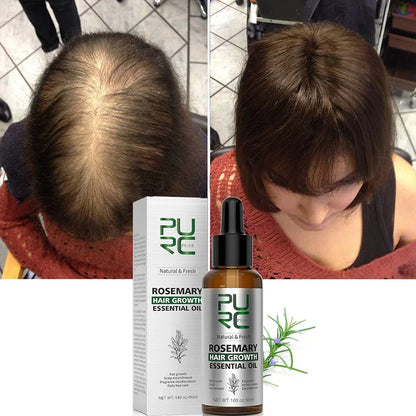 Rosemary Hair Growth Essential Oil - Wholesalus