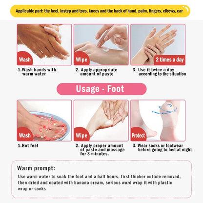Dead Skin Remover Crack Cream - Wholesalus