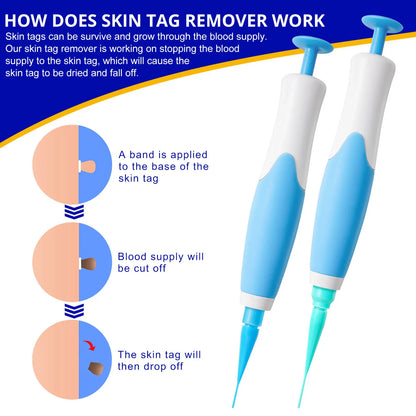 Skin Tag Removal Kit - Wholesalus