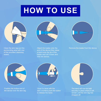 Skin Tag Removal Kit - Wholesalus