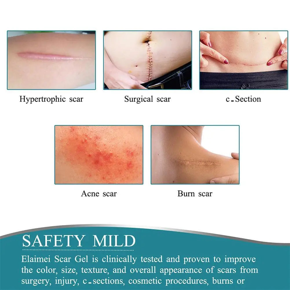 Silicone Gel Scar Repair Patch