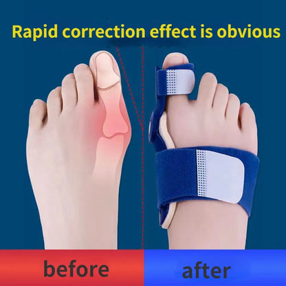 Flexible Orthopaedic Bunion Corrector - Wholesalus