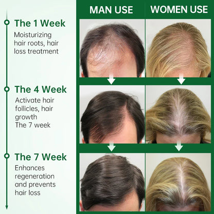 Rosemary Hair Growth Essential Oil - Wholesalus
