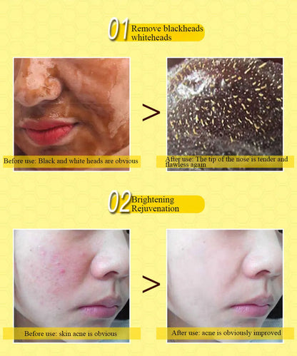 Dead Skin Removal Peel-off Mask - Wholesalus