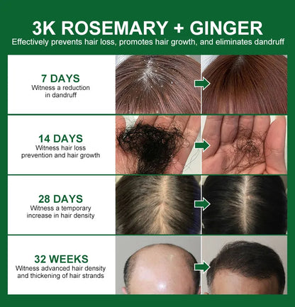 Rosemary Hair Growth Essential Oil - Wholesalus