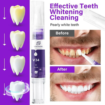 Whitening Dental Gel Pen - Wholesalus