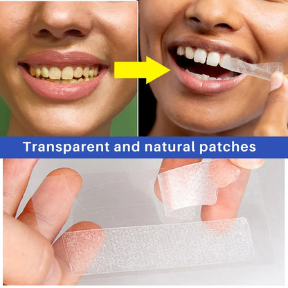 Teeth Whitening Strips - Wholesalus