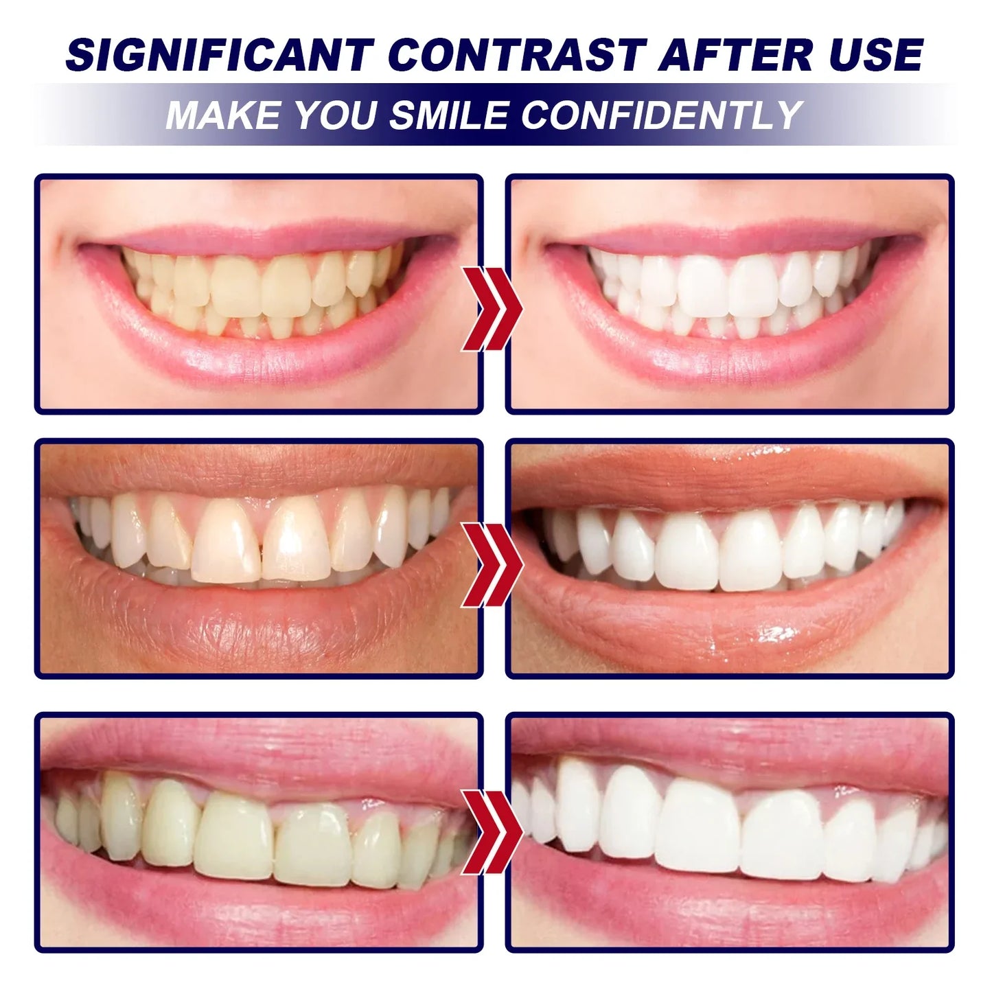 Teeth Whitening Strips - Wholesalus