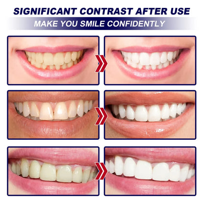Teeth Whitening Strips - Wholesalus