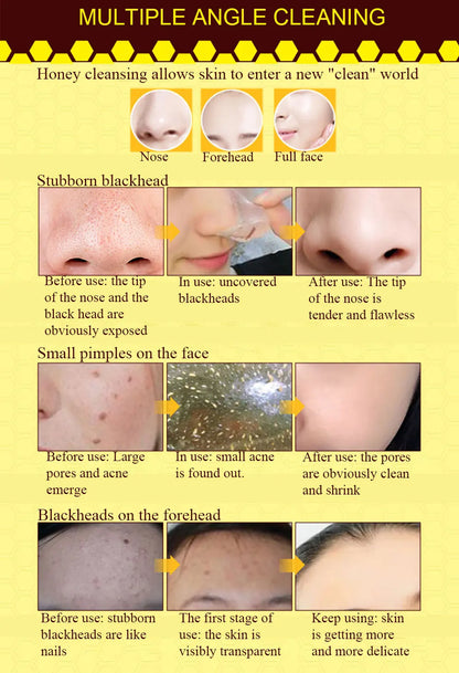 Dead Skin Removal Peel-off Mask - Wholesalus
