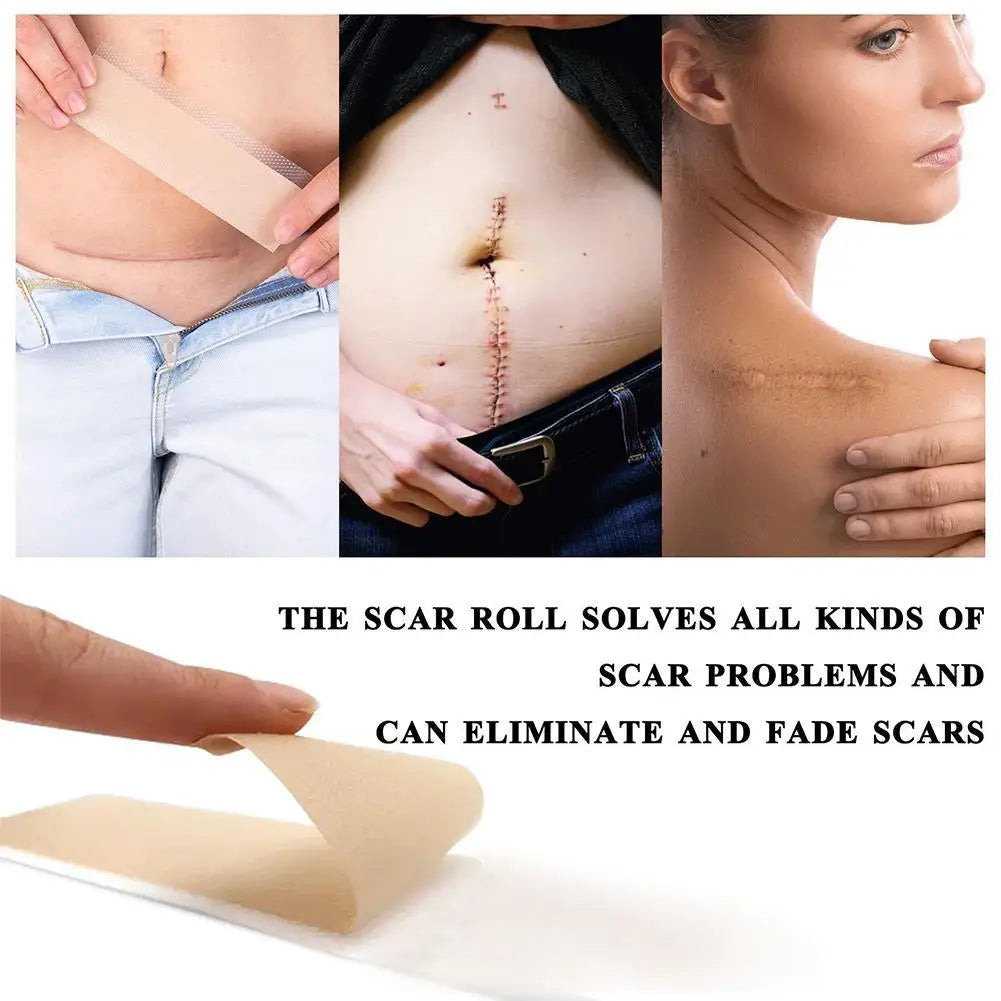 Silicone Gel Scar Repair Patch