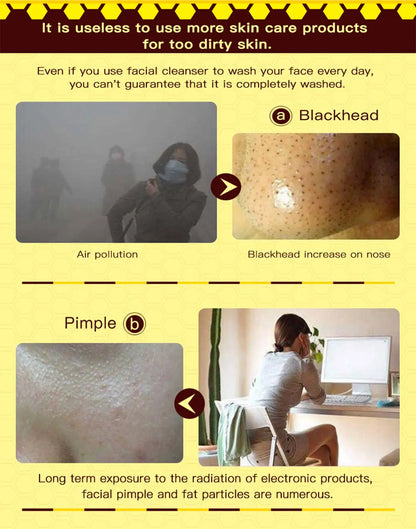 Dead Skin Removal Peel-off Mask - Wholesalus