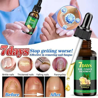 Nail Fungus Defender Serum - Wholesalus