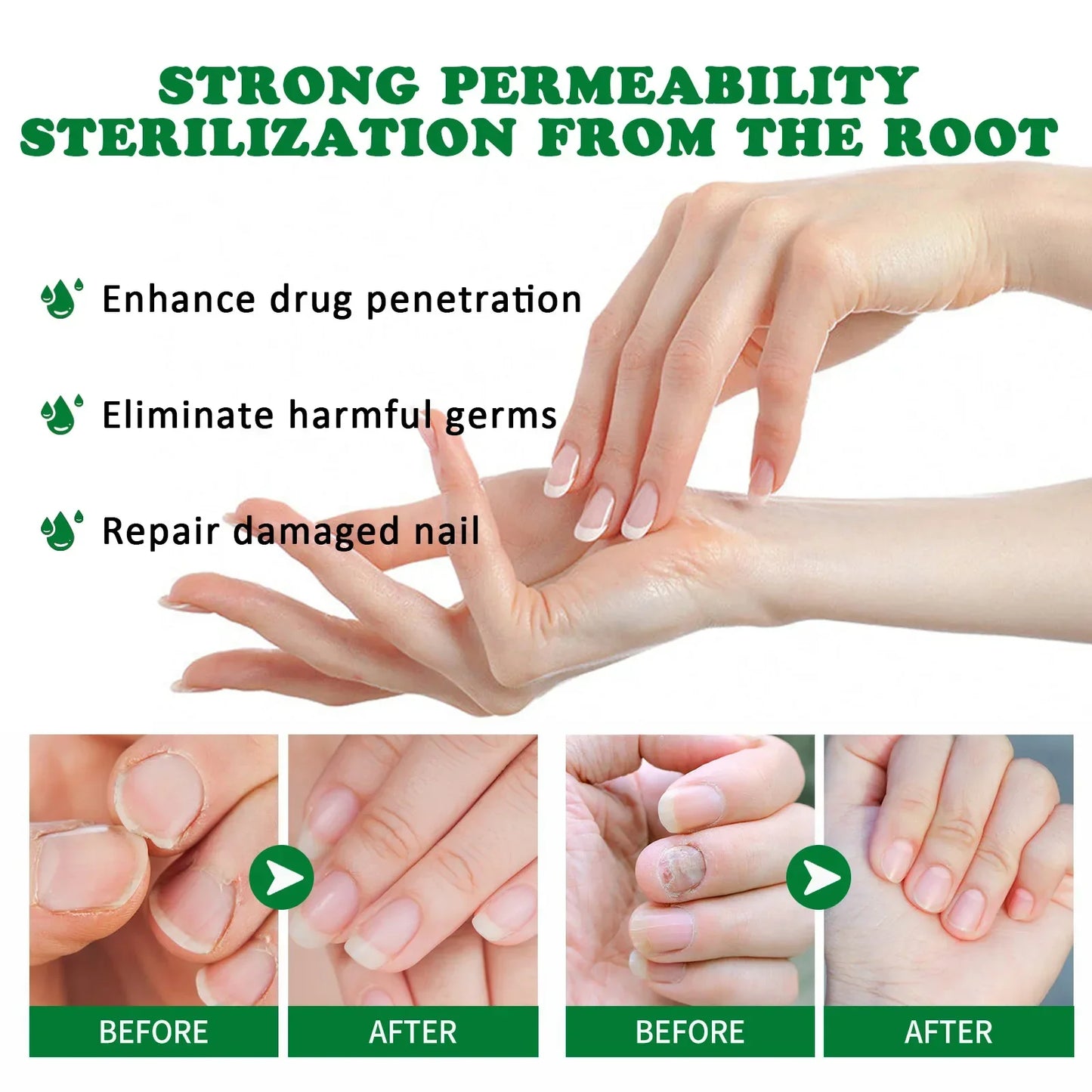 Nail Fungus Defender Serum - Wholesalus