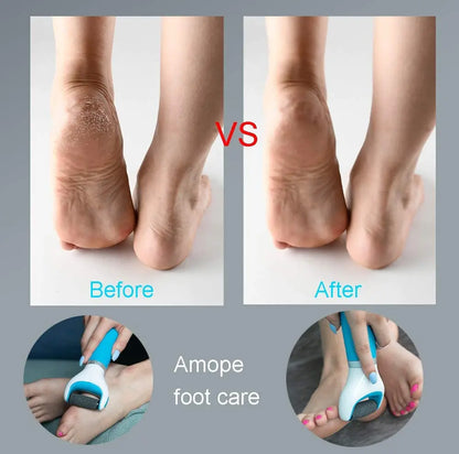USB Foot Callus Remover Pedicure Tool - Wholesalus