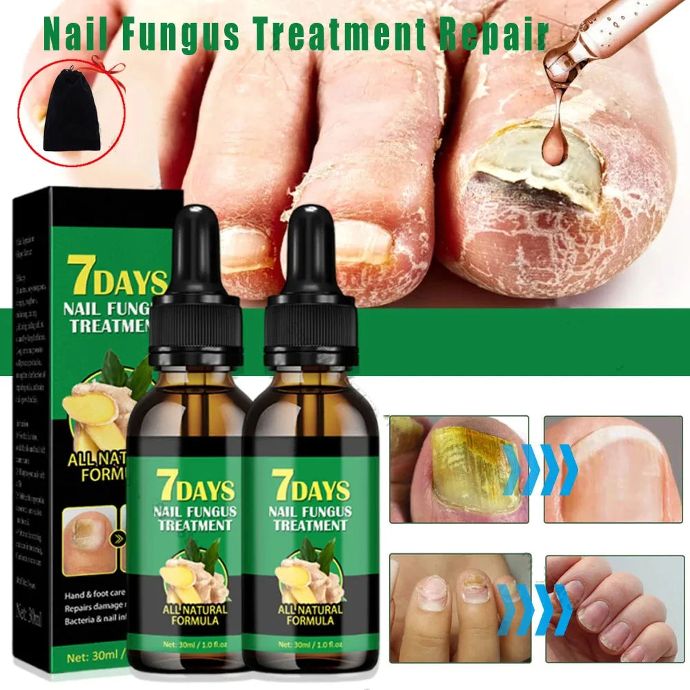 Nail Fungus Defender Serum - Wholesalus
