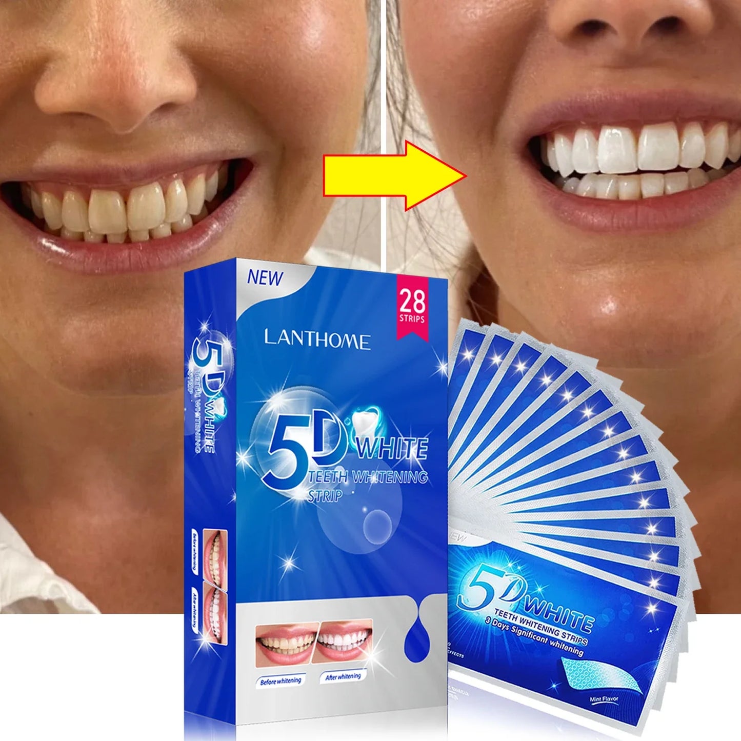 Teeth Whitening Strips