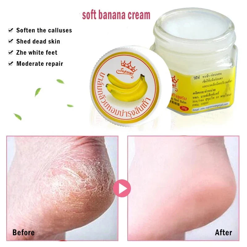 Dead Skin Remover Crack Cream