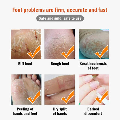 Dead Skin Remover Crack Cream - Wholesalus