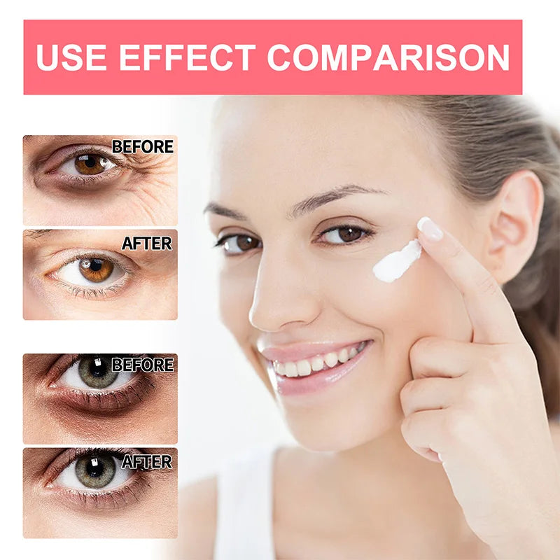 Anti Wrinkle Eye Bag Remover Cream