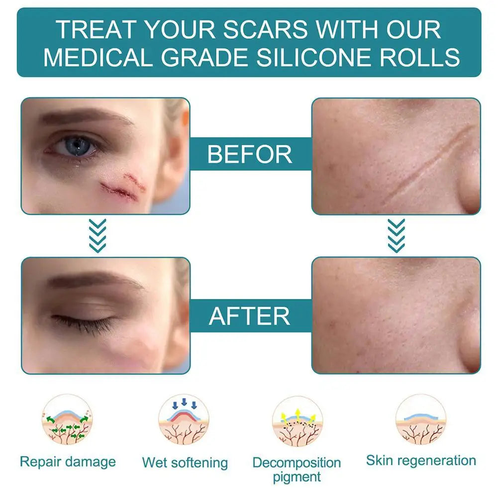 Silicone Gel Scar Repair Patch