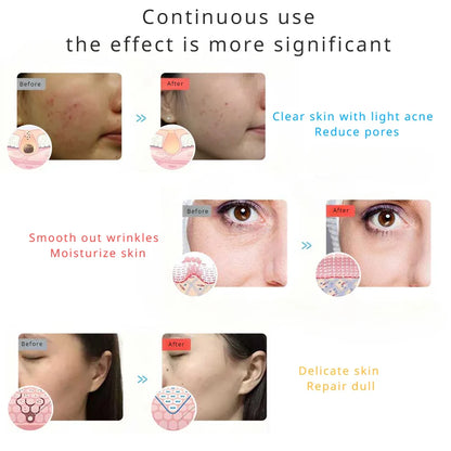 LED Red Light Therapy Facial Mask - Wholesalus