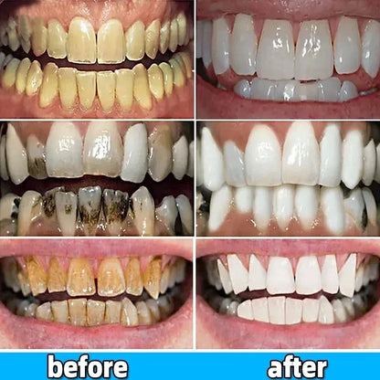 Dental Calculus Removing Toothpaste - Wholesalus