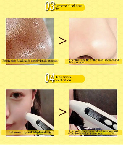 Dead Skin Removal Peel-off Mask - Wholesalus