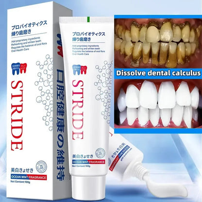 Dental Calculus Removing Toothpaste - Wholesalus