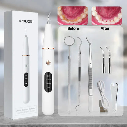 Electric Dental Calculus Remover - Wholesalus