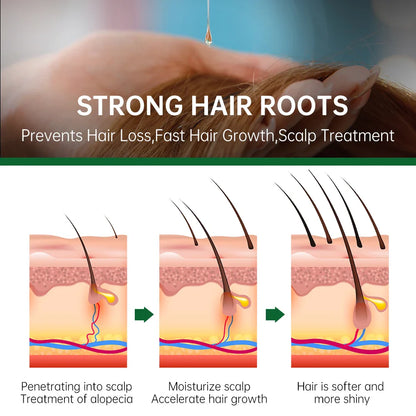 Rosemary Hair Growth Essential Oil - Wholesalus