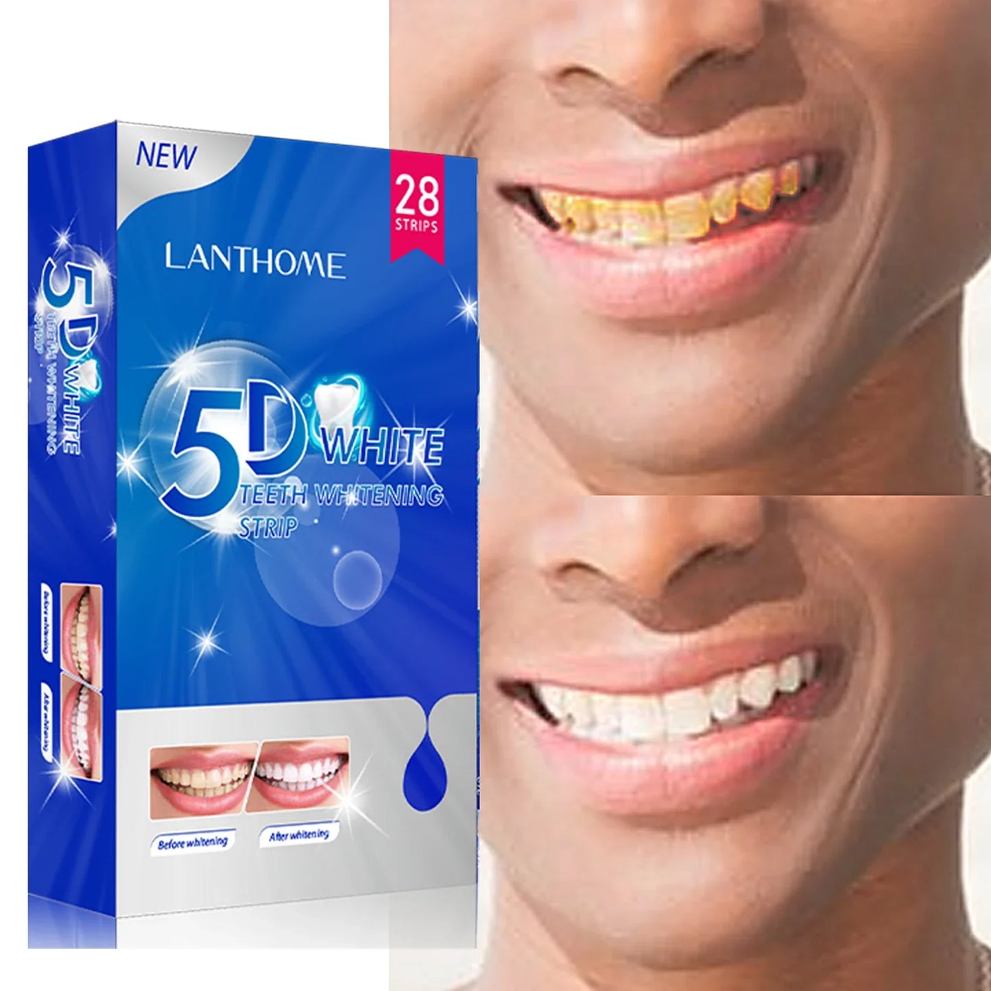 Teeth Whitening Strips