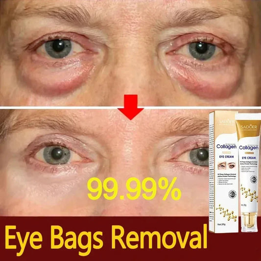 Instant Eye Bag Removal