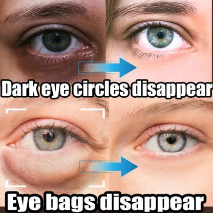 Instant Eye Bag Removal - Wholesalus