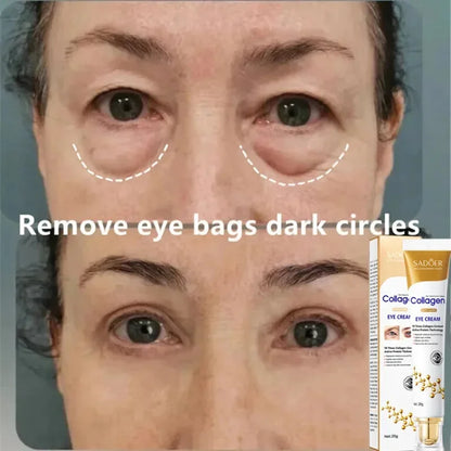 Instant Eye Bag Removal - Wholesalus
