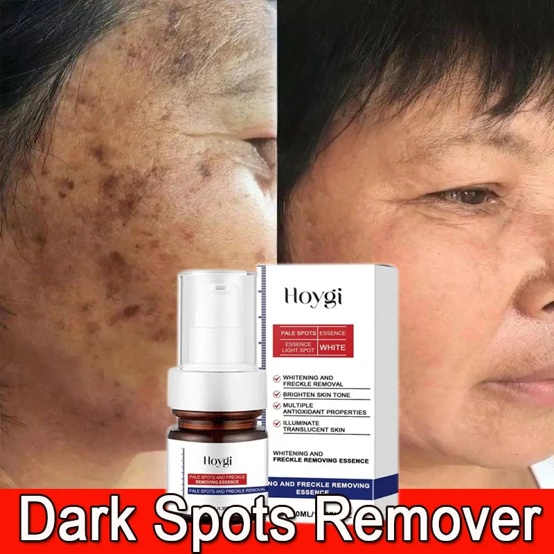 Moisturizing Dark Spots Remover - Wholesalus