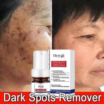 Moisturizing Dark Spots Remover - Wholesalus