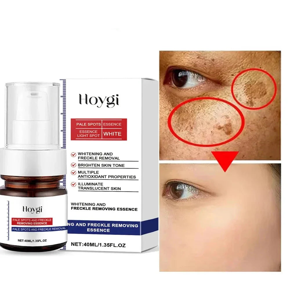 Moisturizing Dark Spots Remover - Wholesalus