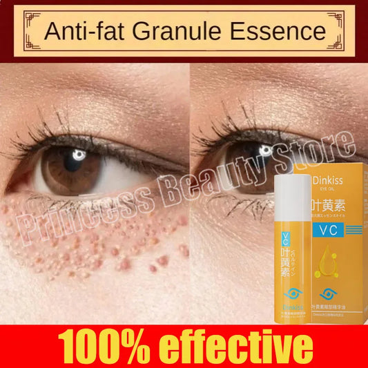 Under-Eye Granule Removal Serum - Wholesalus