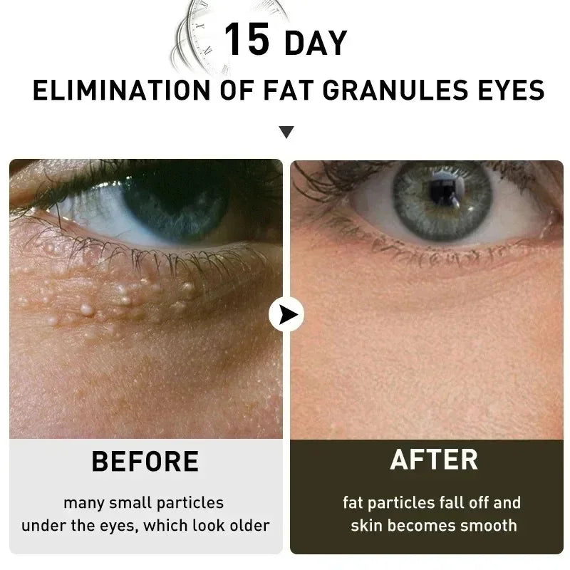 Under-Eye Granule Removal Serum - Wholesalus