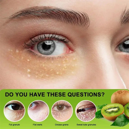 Under-Eye Granule Removal Serum - Wholesalus