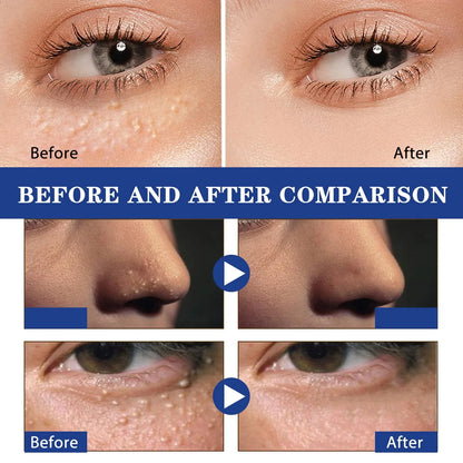 Under-Eye Granule Removal Serum - Wholesalus