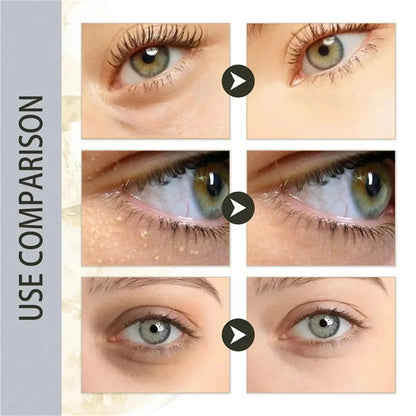 Under-Eye Granule Removal Serum - Wholesalus
