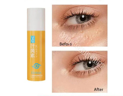 Under-Eye Granule Removal Serum - Wholesalus