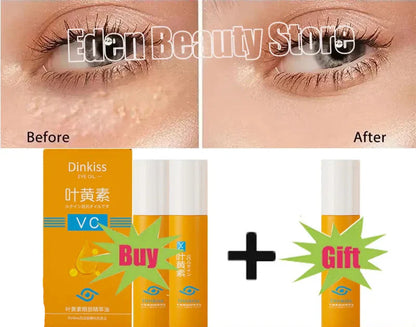 Under-Eye Granule Removal Serum - Wholesalus