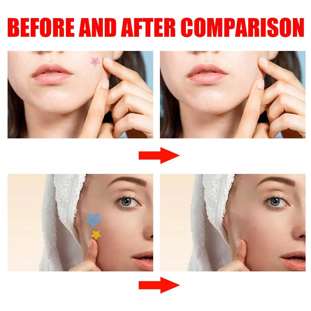 Invisible Pimple Patch - Wholesalus