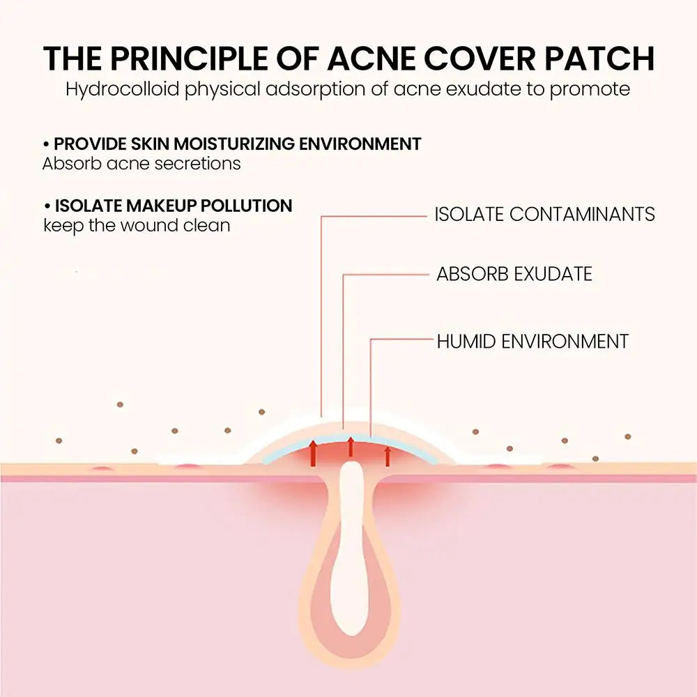 Invisible Pimple Patch - Wholesalus