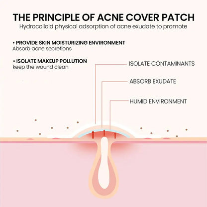 Invisible Pimple Patch - Wholesalus