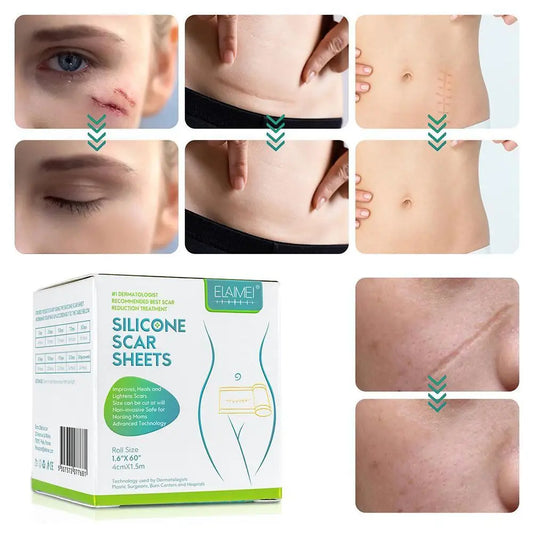 Silicone Gel Scar Repair Patch - Wholesalus