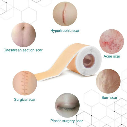 Silicone Gel Scar Repair Patch - Wholesalus